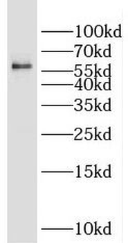 GLYR1 Rabbit Polyclonal Antibody