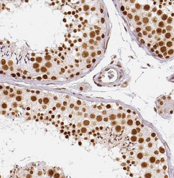 GLYR1 Rabbit Polyclonal Antibody