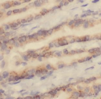 CSF2 Rabbit Polyclonal Antibody