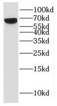 GMPS Rabbit Polyclonal Antibody