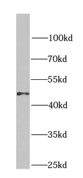 GNAI3 Rabbit Polyclonal Antibody