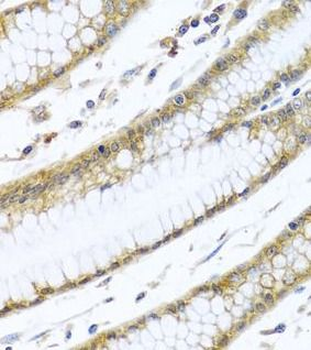 GNAI3 Rabbit Polyclonal Antibody