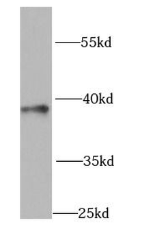 GNAO1 Rabbit Polyclonal Antibody