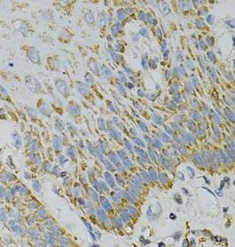 GNAO1 Rabbit Polyclonal Antibody