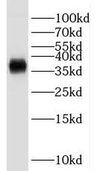 GNB2 Rabbit Polyclonal Antibody