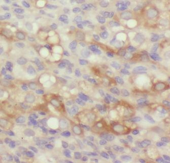 GNB2 Rabbit Polyclonal Antibody