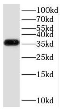 GNB3 Rabbit Polyclonal Antibody
