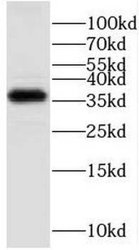 GNB3 Rabbit Polyclonal Antibody