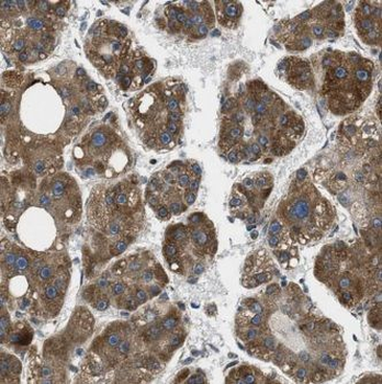 GNB3 Rabbit Polyclonal Antibody