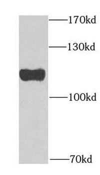 GNE Rabbit Polyclonal Antibody