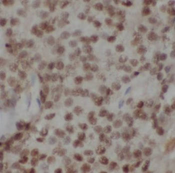 GNL2 Rabbit Polyclonal Antibody