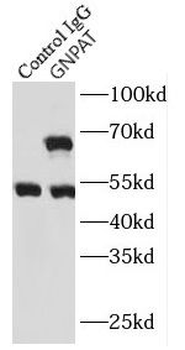 GNPAT Rabbit Polyclonal Antibody