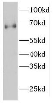 GNPAT Rabbit Polyclonal Antibody