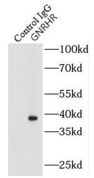 GNRHR Rabbit Polyclonal Antibody