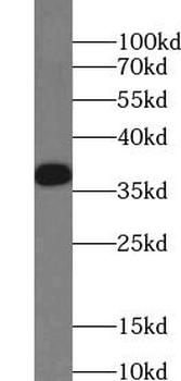 GNRHR Rabbit Polyclonal Antibody
