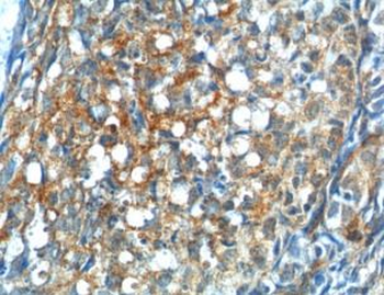 GNRHR Rabbit Polyclonal Antibody