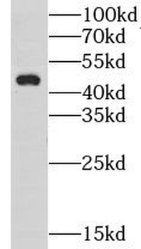 GORAB Rabbit Polyclonal Antibody