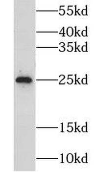 GOSR2 Rabbit Polyclonal Antibody