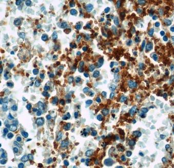 GP9 Rabbit Polyclonal Antibody