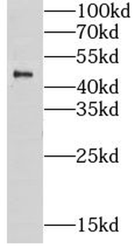 GPKOW Rabbit Polyclonal Antibody