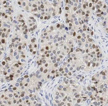 GPKOW Rabbit Polyclonal Antibody