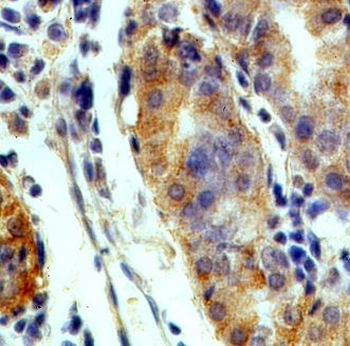P2RY14 Rabbit Polyclonal Antibody