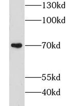 GPR161 Rabbit Polyclonal Antibody