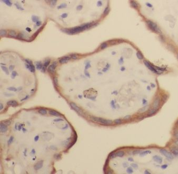 GPR161 Rabbit Polyclonal Antibody