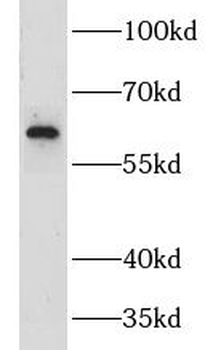 GPR183 Rabbit Polyclonal Antibody