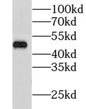 GPR37 Rabbit Polyclonal Antibody