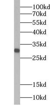 GRAP Rabbit Polyclonal Antibody