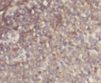 GRAP Rabbit Polyclonal Antibody