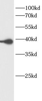GRAP2 Rabbit Polyclonal Antibody