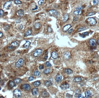 GRAP2 Rabbit Polyclonal Antibody
