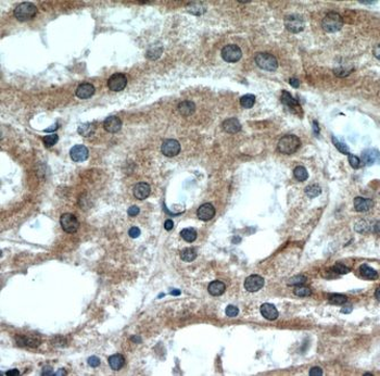 GREM2 Rabbit Polyclonal Antibody
