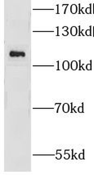 GRID1 Rabbit Polyclonal Antibody