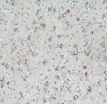GRID1 Rabbit Polyclonal Antibody