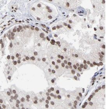 NDUFA13 Rabbit Polyclonal Antibody