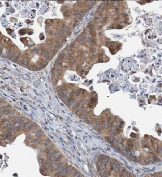 CXCL1 Rabbit Polyclonal Antibody