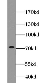 HSPA9 Rabbit Polyclonal Antibody
