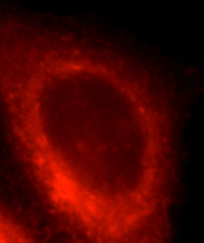 HSPA9 Rabbit Polyclonal Antibody