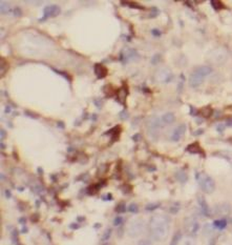 HSPA9 Rabbit Polyclonal Antibody