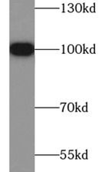 HSP90B1 Rabbit Polyclonal Antibody