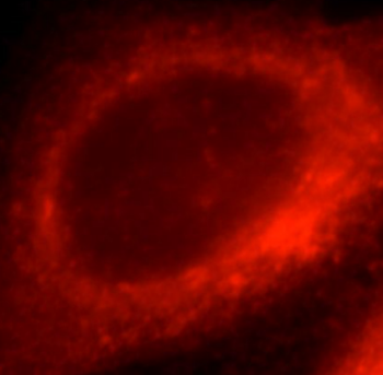 HSP90B1 Rabbit Polyclonal Antibody