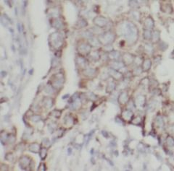 HSP90B1 Rabbit Polyclonal Antibody