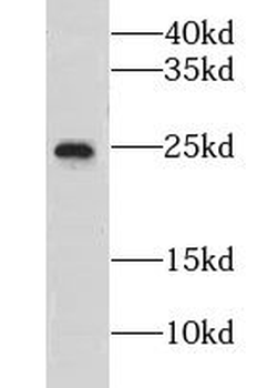 GRPEL1 Rabbit Polyclonal Antibody