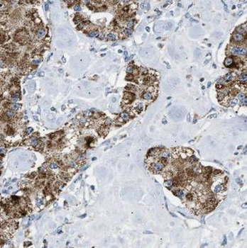 GRPEL1 Rabbit Polyclonal Antibody