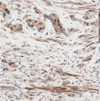 GRWD1 Rabbit Polyclonal Antibody