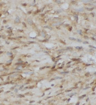GOSR1 Rabbit Polyclonal Antibody