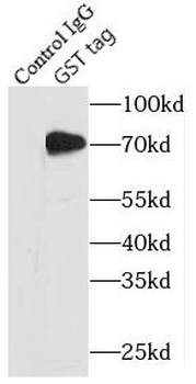 GST tag Mouse Monoclonal Antibody